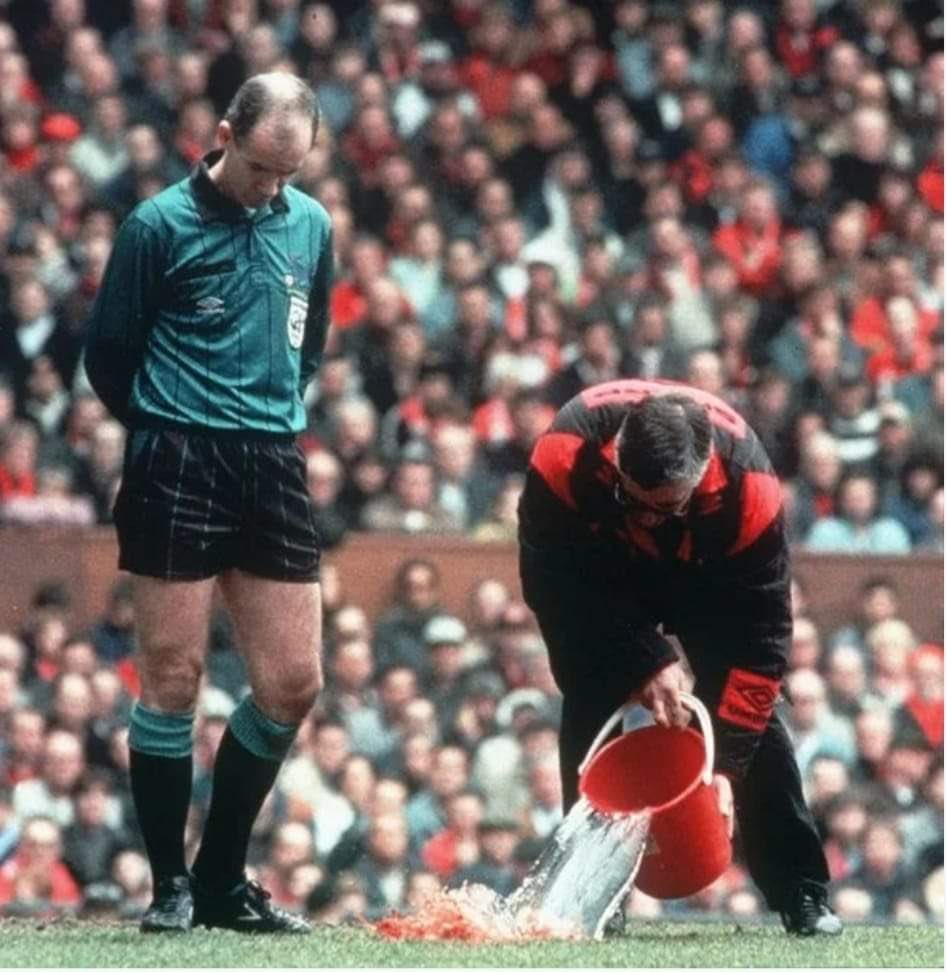 28-years ago, Coventry's David Busst broke his leg against Manchester United. 🤕 This is what his leg looks like these days. 🤯 Incredibly, he still plays football and is a coach. Absolute inspiration. 🤝