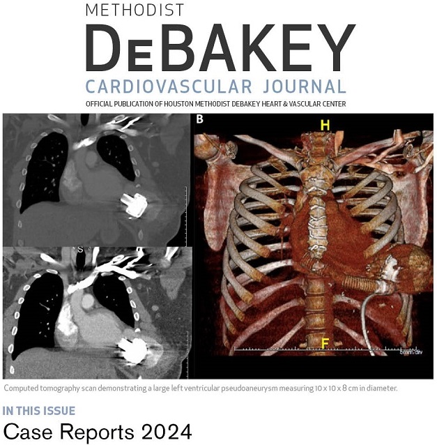 Have an interesting case to share? #DeBakeyCVJournal accepts case reports describing novel clinical scenarios related to CVD. Submit ~1K words with images/video at journal.houstonmethodist.org/about/submissi…

Or submit Multimodality Museum Images. See our Special Collections journal.houstonmethodist.org/collections