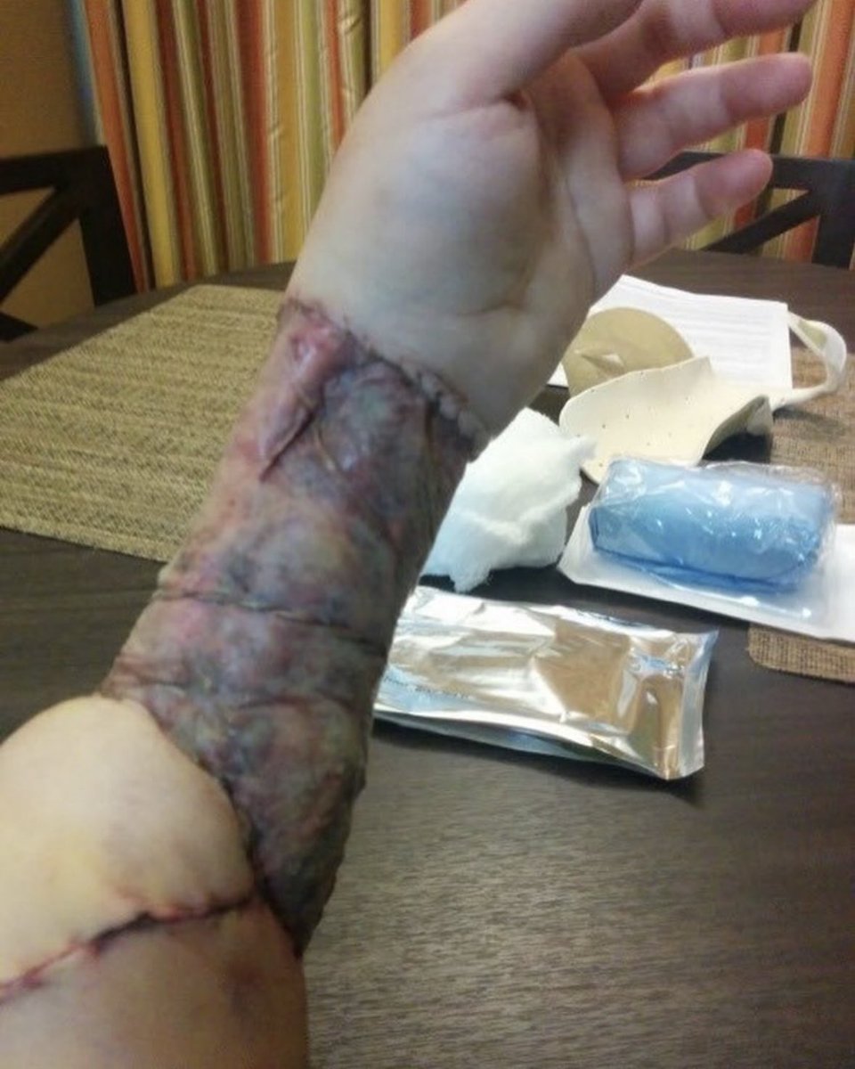 usdogeservice's tweet photo. This is the effects after Gender Affirming surgery, the left wants teenagers to be able to get it done. https://t.co/Ws0yUKikEg