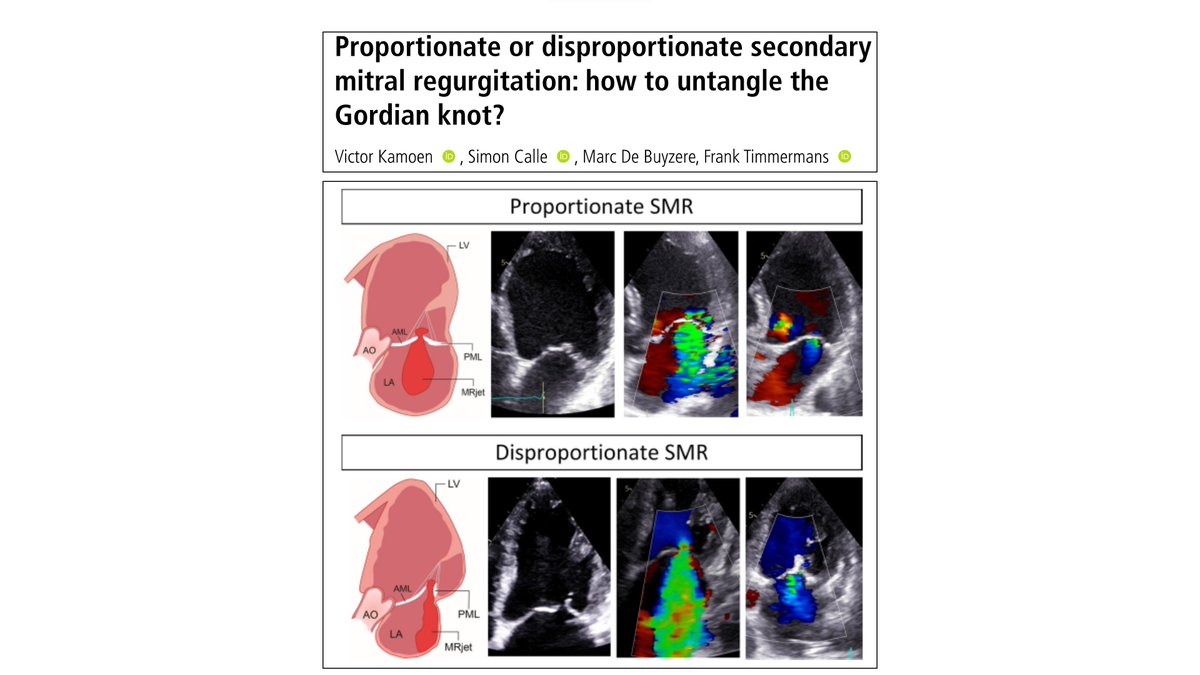 #EchoDGK2024 Frank Timmermans (Gent) @echo_batman fantastic talk 🗣️ The consequences of improper MR grading for cardiac surgeons: #echofirst @iamritu @fiore_corrado @denisamuraru @eromerodorta @NMerke @MotocAndreea @PhilippLurz @DGK_org @DonalErwan @FGraziani_Grace @NadeenFaza