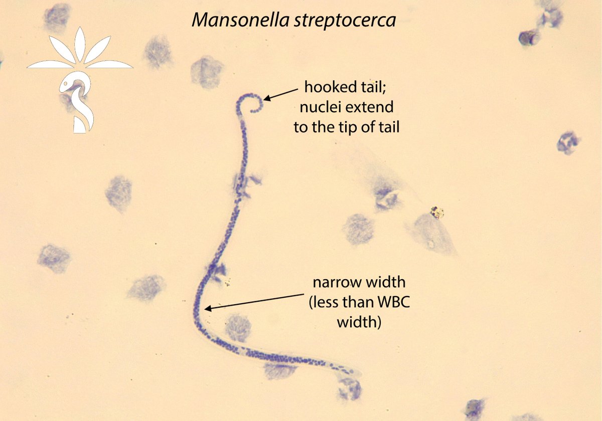 The answer to the #Parasite Case 745 is now up: Mansonella streptocerca. See further discussion here: parasitewonders.blogspot.com/2024/04/case-o…. Thank you Idzi Potters and @ ITMantwerp for this great 🪱 case! #mayopath #pathology #CrittersOnTwitter #PathBugs