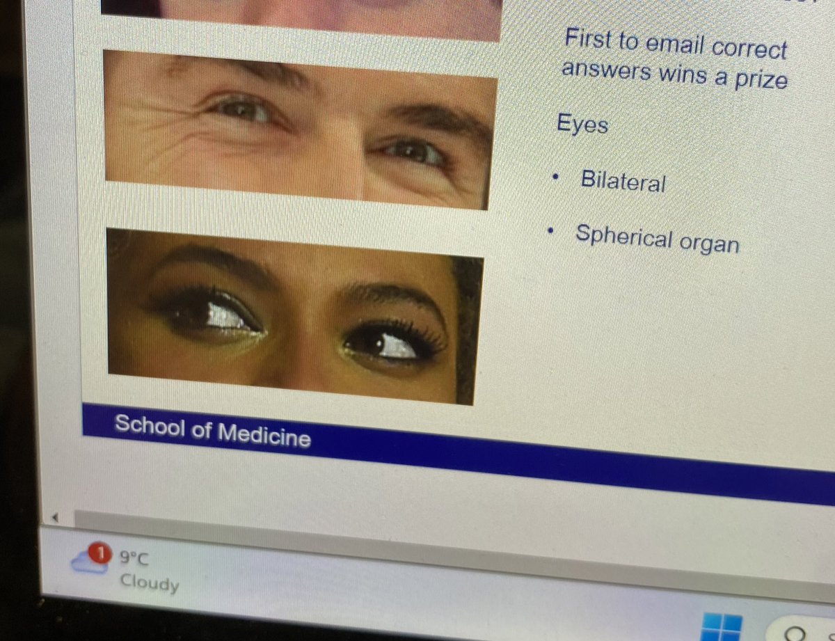 Started the ophthalmology module at university and LOOK WHOSE BEING REFERENCED!!