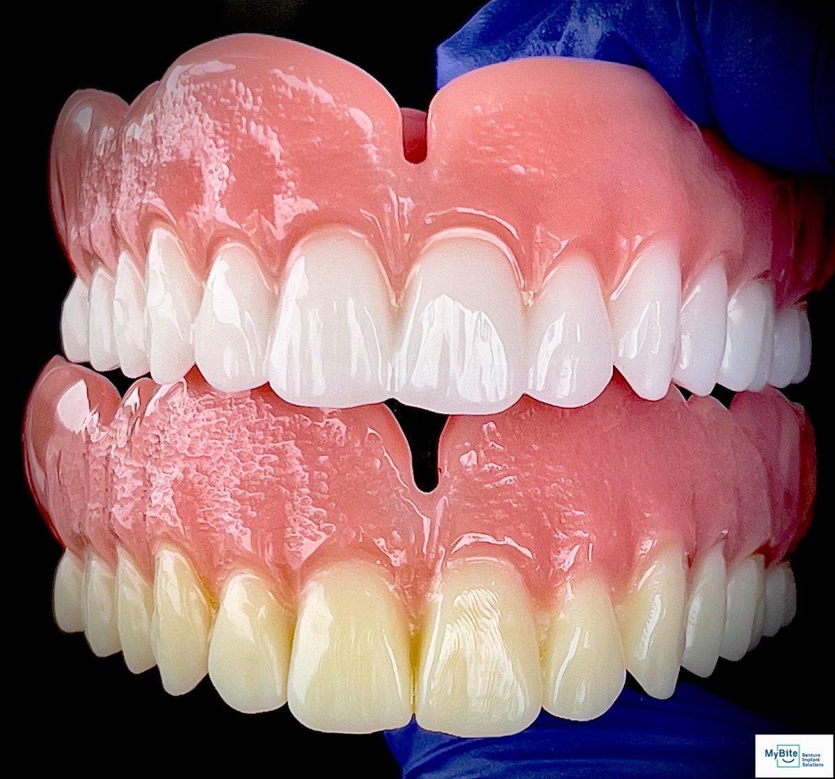 🌟Milled vs 3D Printed: Can you guess which one is milled vs 3D printed? 👀 💎 Which do you prefer? Let us know in the comments! 💬 #milledvs3Dprinte d#dentaltechnology #beautifulsmiles #dentures #yycdentures #calgary #yyc #milled #3dprinted #yycdenturegang