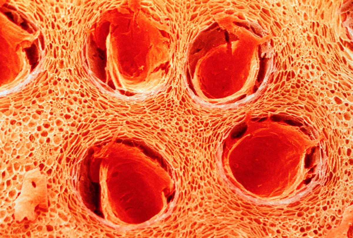 microscopic image of orange peel