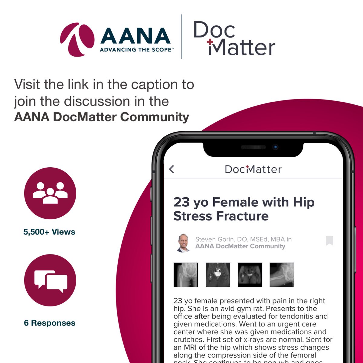 Gain expert tips and advice on your most challenging clinical cases – the AANA DocMatter Community is the only online medical community where you’ll receive helpful, high-quality advice from colleagues across the globe. Participate in the community: docmatter.com/aana