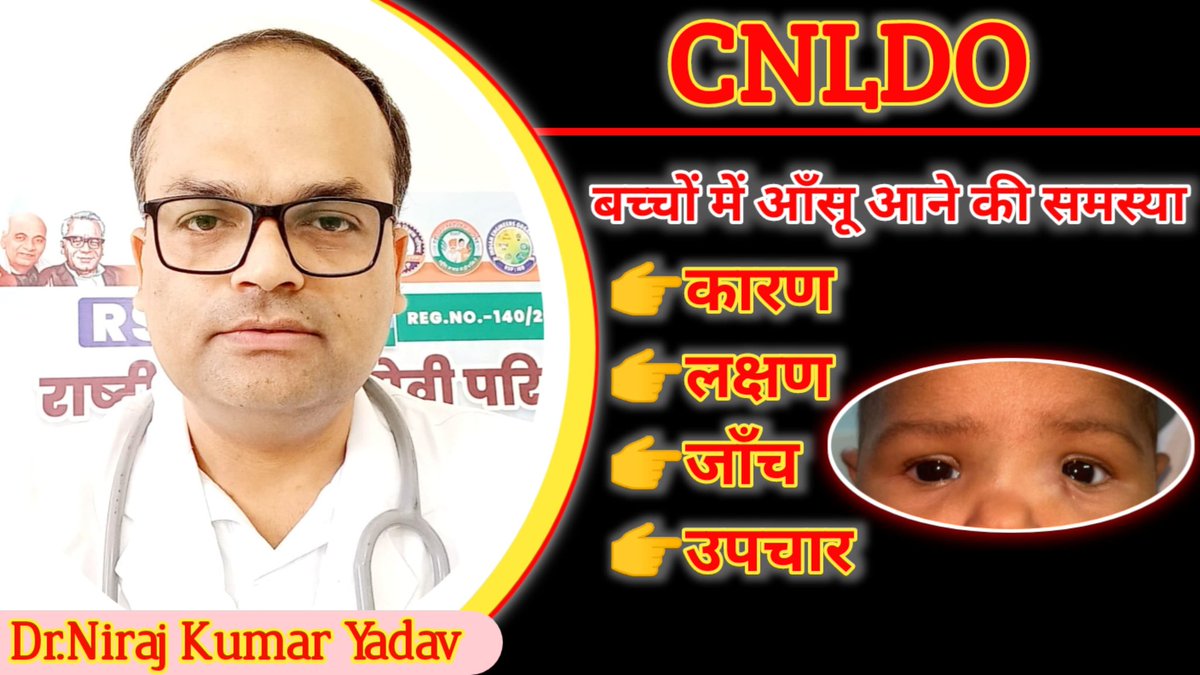 यदि आपके बच्चे की आंखों से आंसू आने की समस्या लगातार बनी हुई है तो यह वीडियो अवश्य देखें। #watering #eyes
youtu.be/eLgSYZ_LYbo?si…