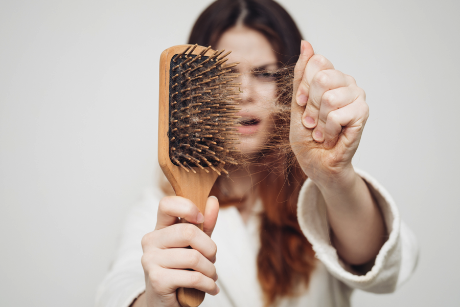Can Iodine Help With Hair Loss? ow.ly/CU9850DkhMz #lookgood #behealhy #alrightnow #alrighters