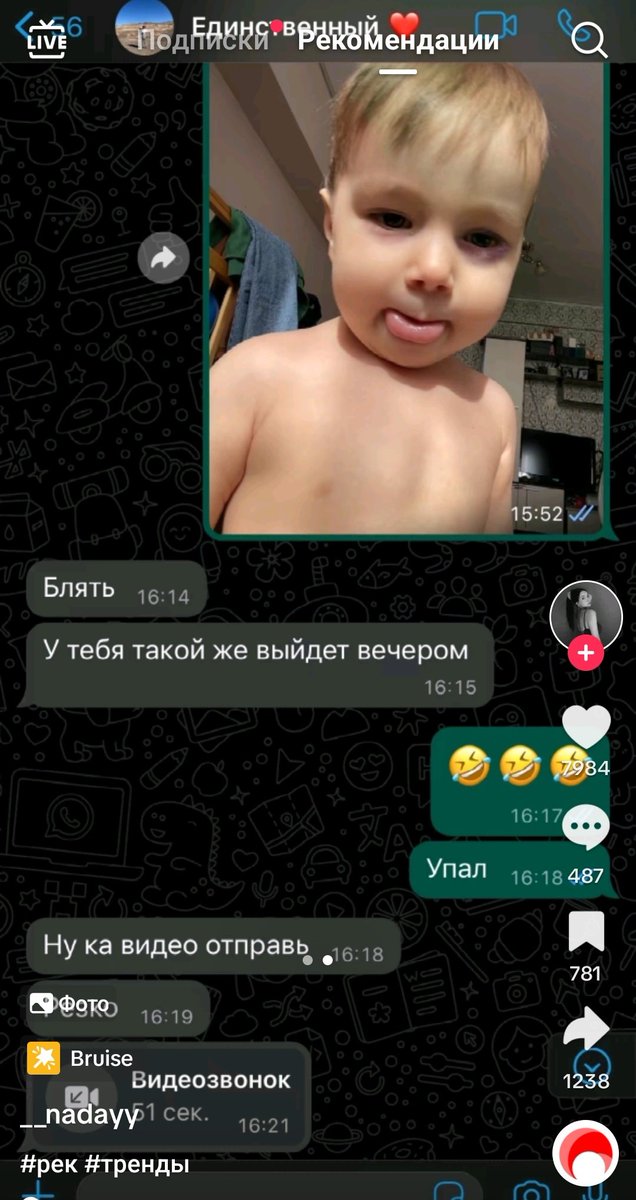 _zlusya_'s tweet photo. ЭТО ЧО БЛЯТЬ ЗА ЗАЛУПА https://t.co/0kEy67he0q