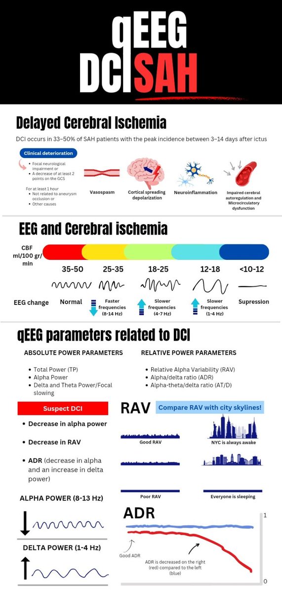 When do you suspect DCI in qEEG? These are the highlights. Created between EEG-texts with our cool and very talented @er_neuro #NeuroTwitter #MedEd #EEG @EmoryNeuroCrit @caseyalbin @REMatthewsMD @e_gleich @EEGTalk