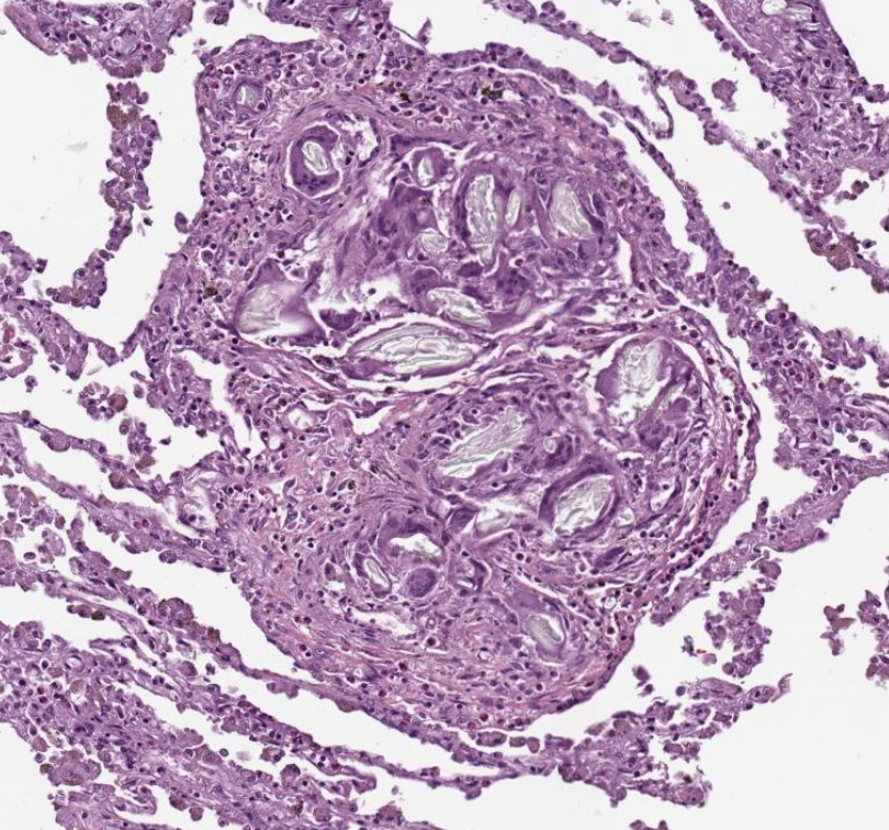 anueru432's tweet photo. Day 2 of #dpatweet @dpatweet review! Thank you for all the learning points and pearls of wisdom for the review series!
#pathtwitter https://t.co/lzh4fg86Vb
