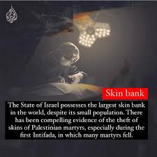 Which country has the largest skin bank #MassGraves #LookAtTheStateOfIsrael #AndWePray #Namaste @ColinMurray @RachelRileyRR #Creator4giveThem4TheyKnowWhatTheyDo #IDWP #CeasefireNOW #NeverAgain is happening NOW - #OnYourWatch! @mikecoulson48 @SpectreDetector @Zoompad