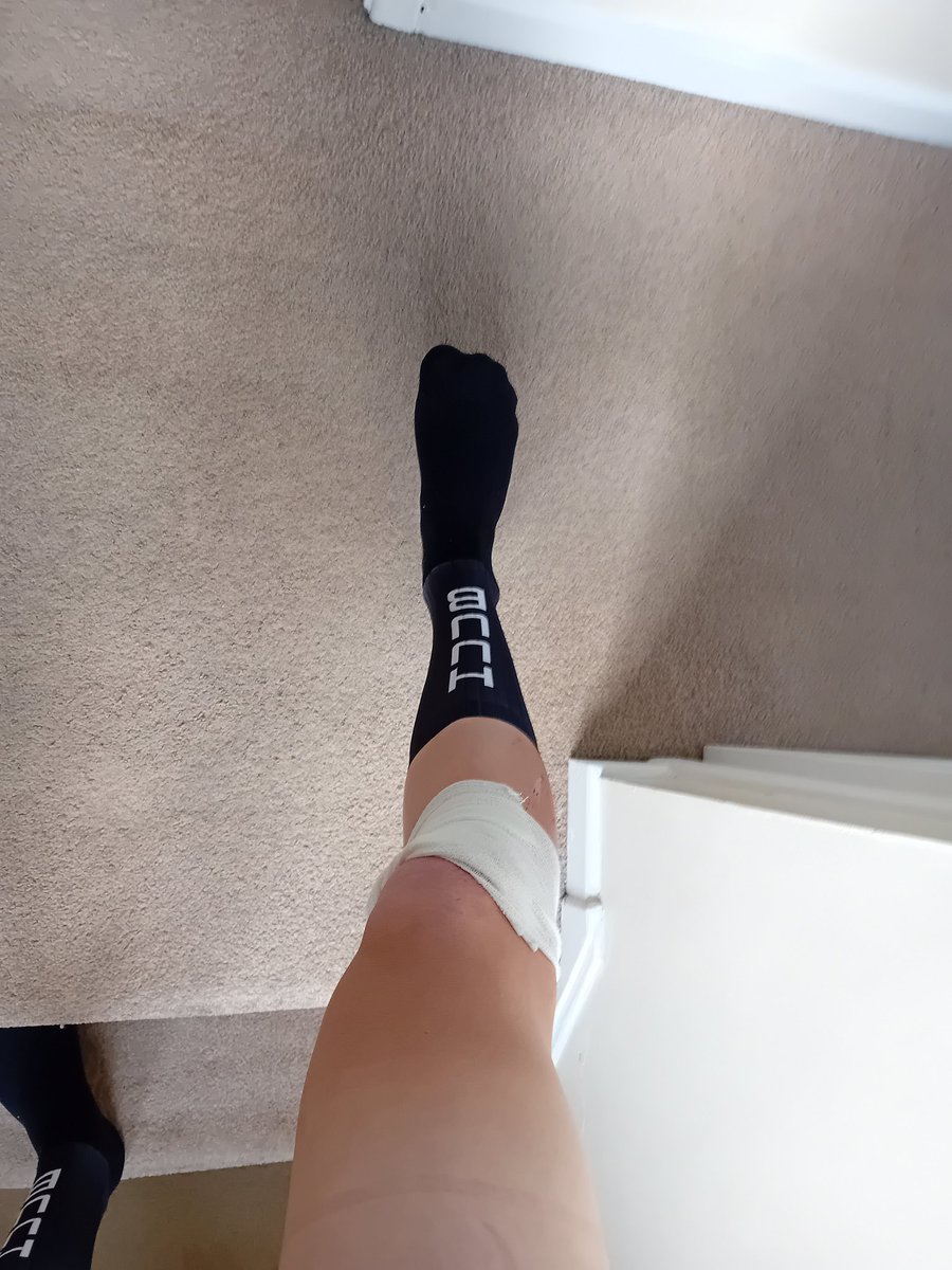 It goes from bad to worse for me, a crash coming in towards the final lap of the PB performance U23 National Series today. Nice to be in the mix of bike racing again though. 

Can't wait to cross a finish line.