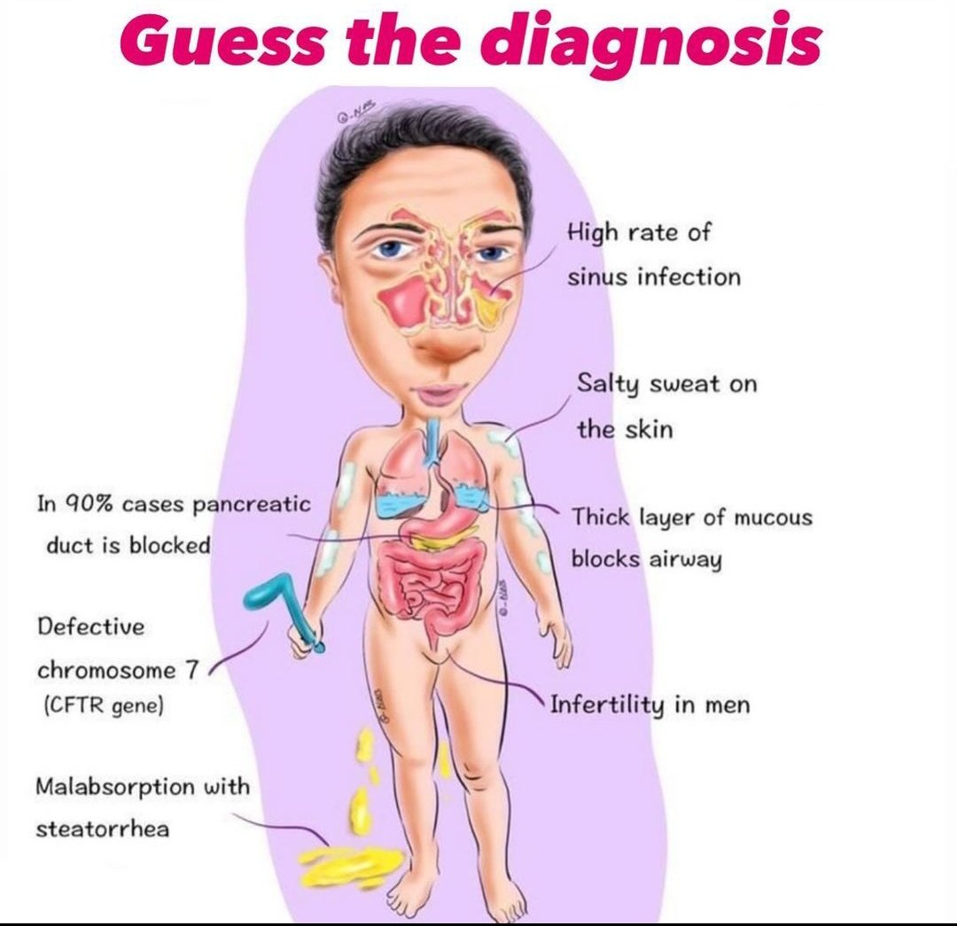 Diagnose the condition? @IhabFathiSulima @fxgodzeuss @Yo97208Yousif #MedTwitter #MedEd