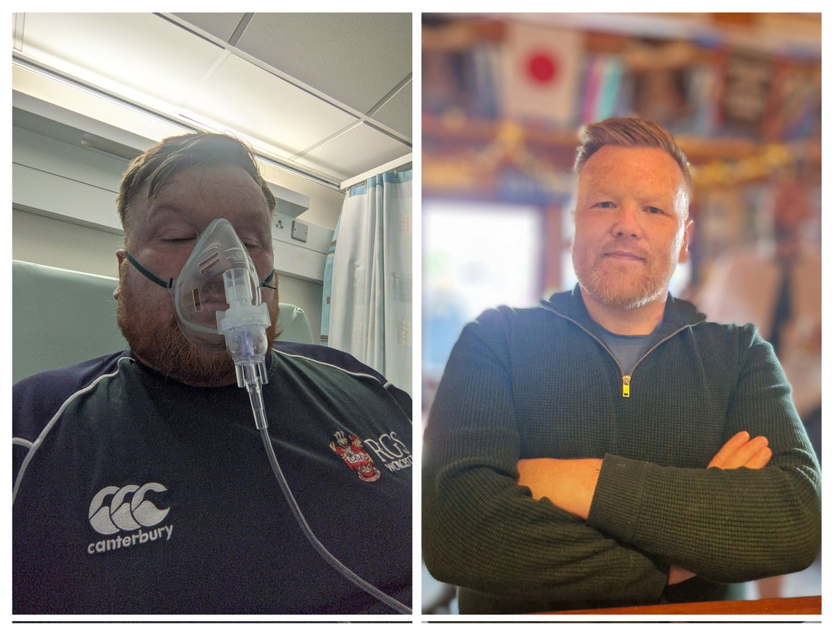 The picture on the left I was in bits and had a lung function of 34%. I'd a cardiac loop monitor placed in my chest and was diagnosed with multi organ sarcoidosis. Picture on the right was taken earlier today 😊 #TherapyWorks #SoberLife