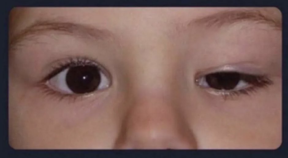 محد …
عيوني لما ابي اصور