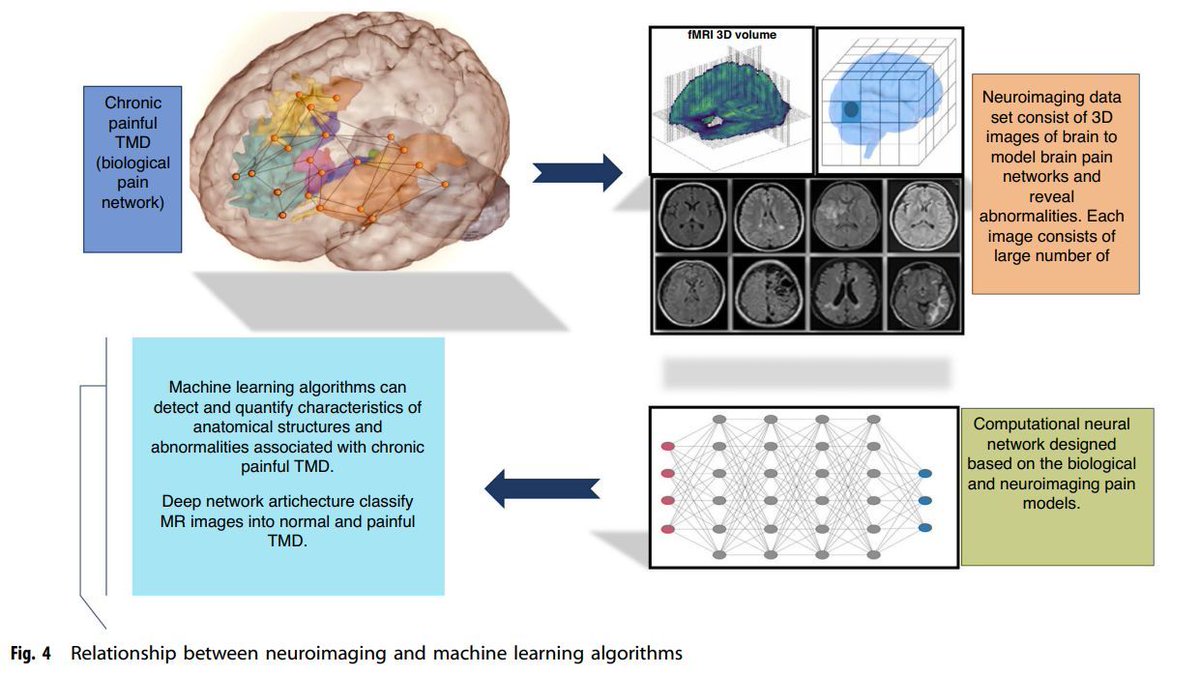 This Paper Explores the Future of Diagnosing and Managing Chronic Painful Temporomandibular Disorders: The Revolutionary Role of #AI and Neuroimaging buff.ly/3THsOje @Marktechpost #HealthTech Cc @jblefevre60 @Ym78200 @kalydeoo @NadiaAbouayoub @enilev