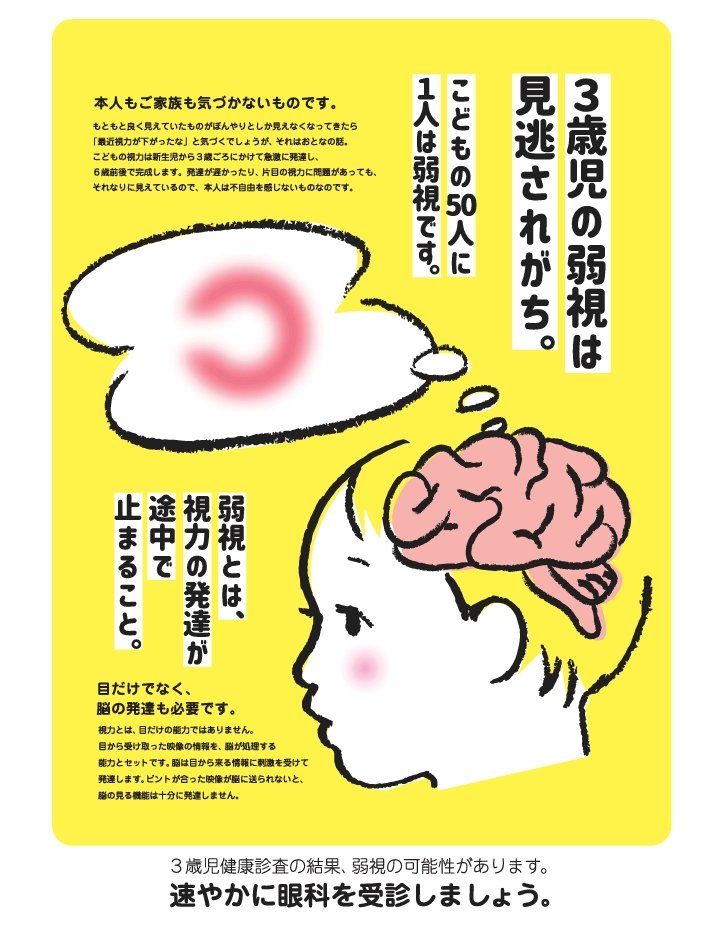 「見えづらいと言っていた。学校検診でもC評価だった。でも、受診させなかった」

片目の視力は0.1程度。強度遠視でした。もう中学生だったから、視力回復しない恐れがある。

実はもっと前から見えてなかったのかもしれない。早期発見・治療で見えるようになる可能性が上がります。