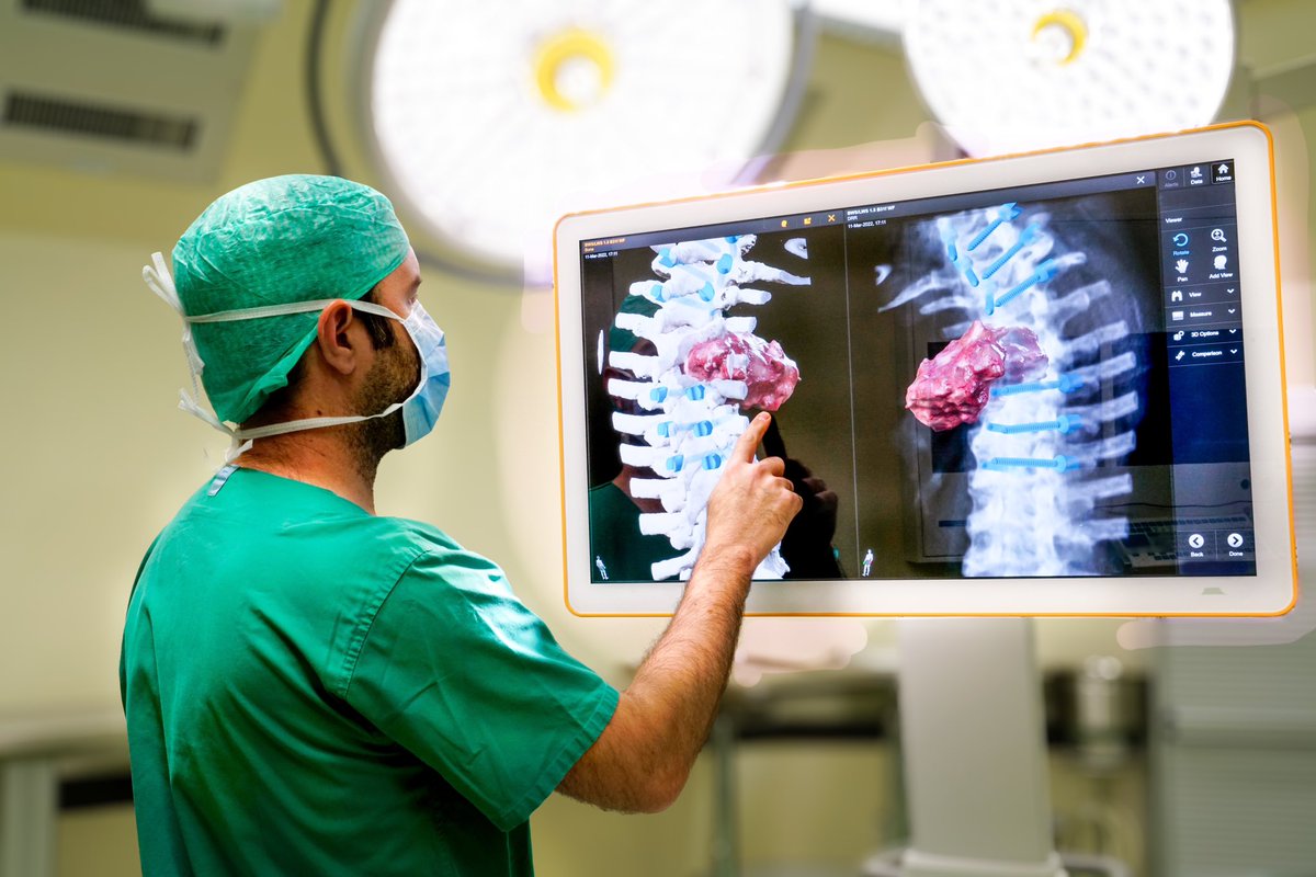 How much #3D do you need in and out the #OR? Only for #teaching and #visualization? For #patients to better understand #diagnosis and #management? For more precise #planning? #safer #surgery? #spine #brain #navigation #software #algorithm #pedicle #screw #tumor #medicalanimation