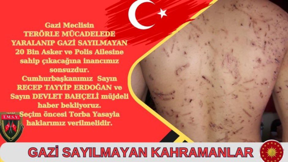 @kocakkonuralp #GazilikHakkımızıİstiyoruz Vatan savunmasıda Kurşun şarapnel yedik. @TmsyGaziler Vatan evlatları 🇹🇷MİLLET 🇹🇷 @RTErdogan @_cevdetyilmaz @dbdevletbahceli @MHP_Bilgi @MhpTbmmGrubu @UlviYonter @kocakkonuralp @celebimehmeta @refik_ozen16 @SayimMadak @leventalyyildiz @mhrmkurt