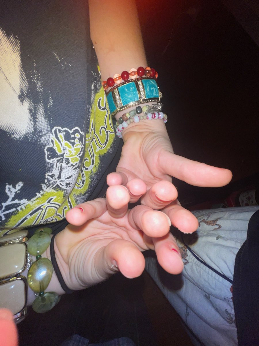 clemenfine69's tweet photo. poop in my fingernails https://t.co/Fxbo6RkwF2