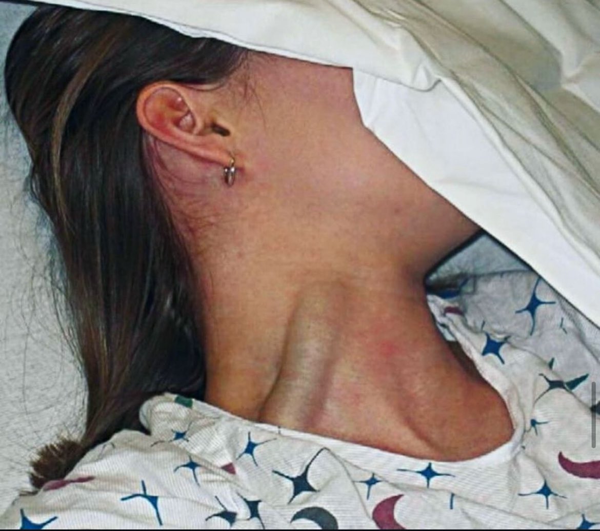 Doctors__squad's tweet photo. What are the  main causes of jugular vein distention ? https://t.co/Cy1ha6NUX1