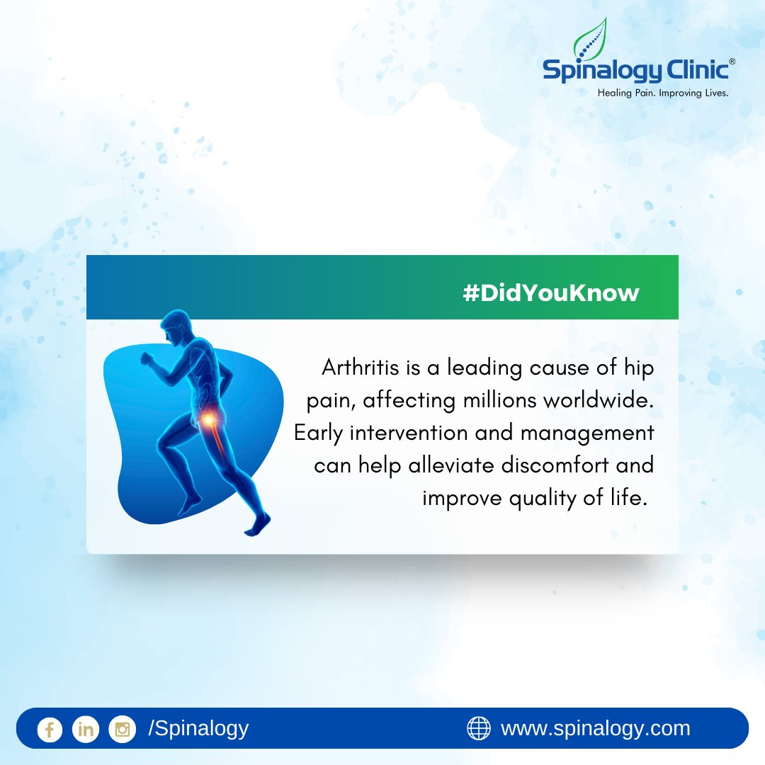 #DidYouKnow        

Arthritis is a leading cause of hip pain, affecting millions worldwide. Early intervention and management can help alleviate discomfort and improve quality of life.

#ArthritisTreatment #arthritispain #ArthritisAwareness 
#spinalogyclinic #india
