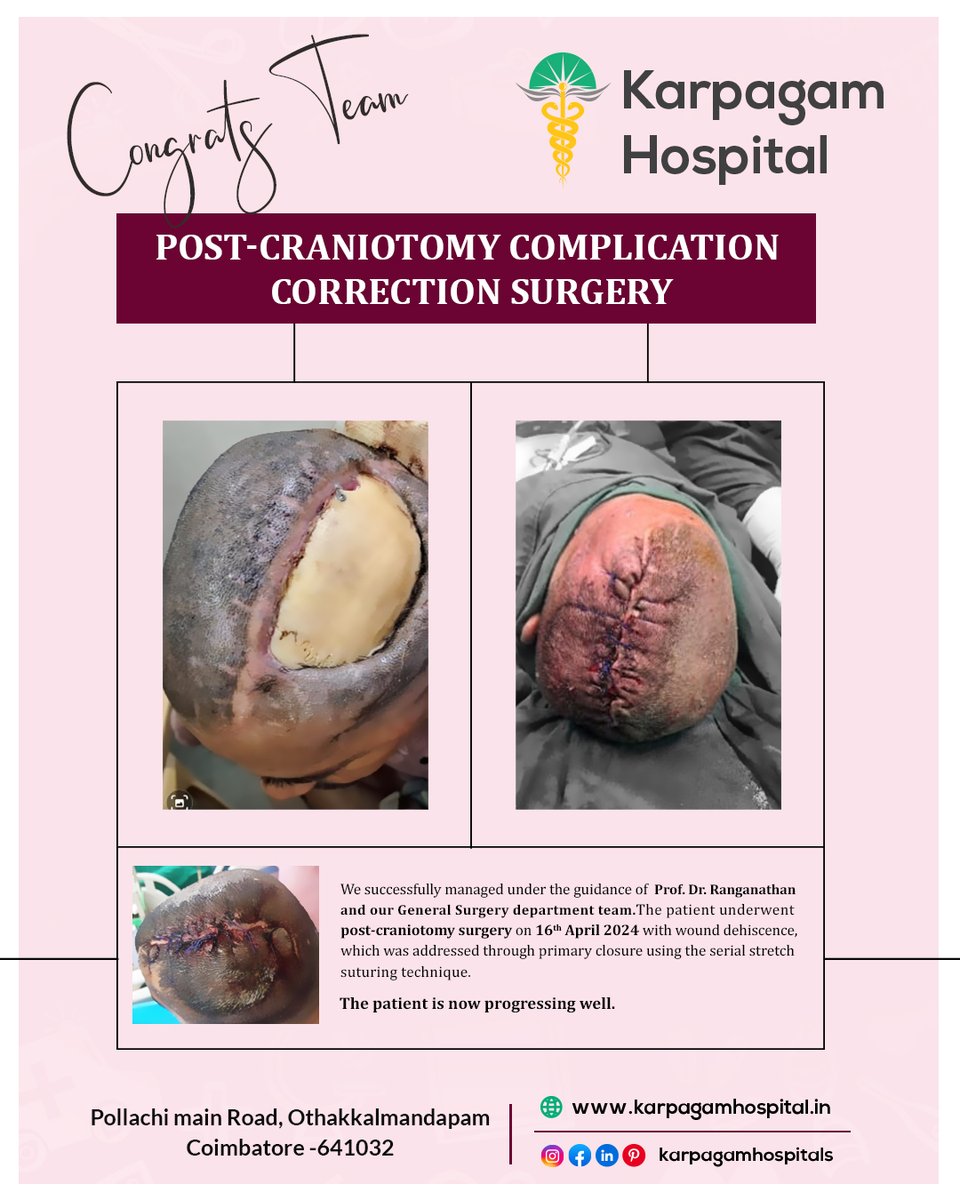 Congrats to the team for the successful surgery! 
Our team, led by Prof. Dr. Ranganathan and our General Surgery department, achieved a successful Post craniotomy complication Correction Surgery on April 16th, 2024.

#MedicalMilestone #HealthcareHeroes