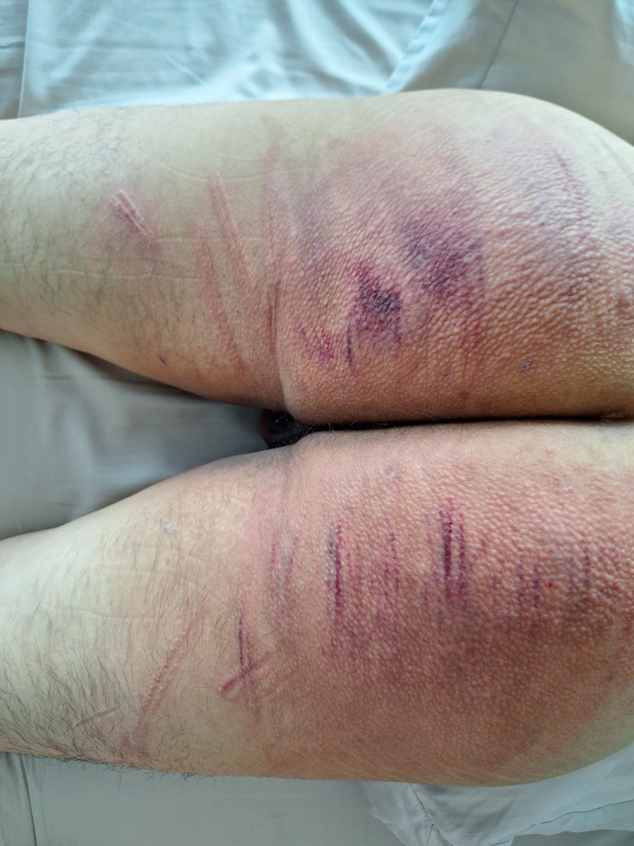 120 canes, well deserved thank you sir