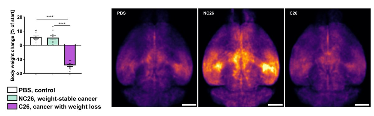 14/n Findings Highlight: Mice with weight-stable cancer showed increased neuronal activity, unlike their weight-losing counterparts. This highlights a previously unknown neurophysiological phenotype in cancer-related weight control. #Cachexia