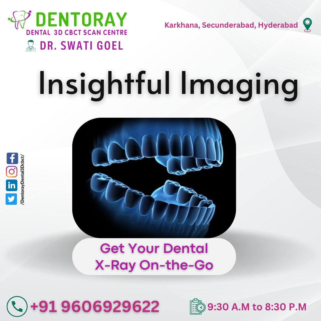 #Dentoray #DrSwatiGoel #DentalXRay #DentalImaging #OnTheGo #ConvenientCare #OralHealth #DentalCare #DentalServices #DentalTechnology #ExpertAnalysis #DiagnosticImaging #Secunderabad #BestScanCentre #TopScanCenter #DentalExpertise #DigitalDentistry #OralHealthCare #DentalClinic