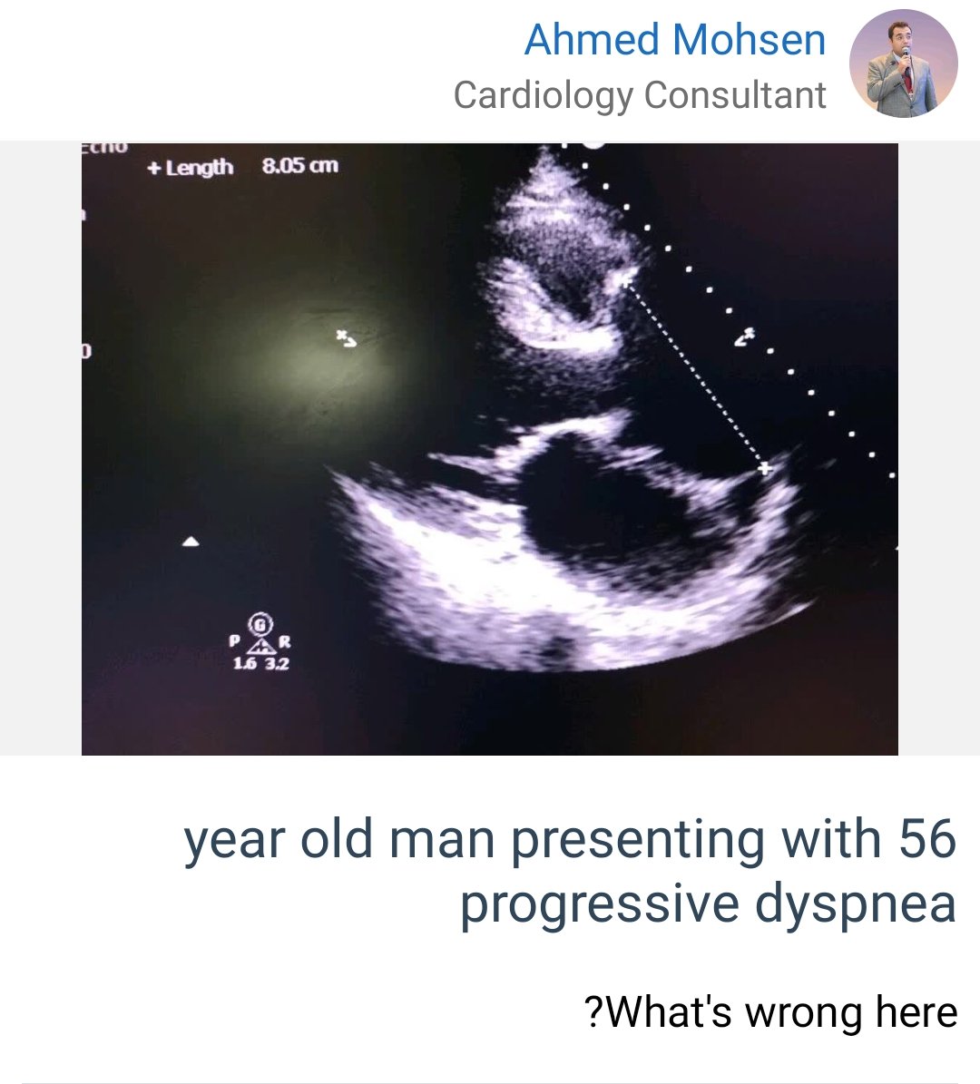 Share your thoughts Vote now in Medshr! The correct answer will be provided in Cardiology Quizzes Medshr group after 24 hours! Join us, post your cases, and enjoy free learning medshr.it/cardioquizzes