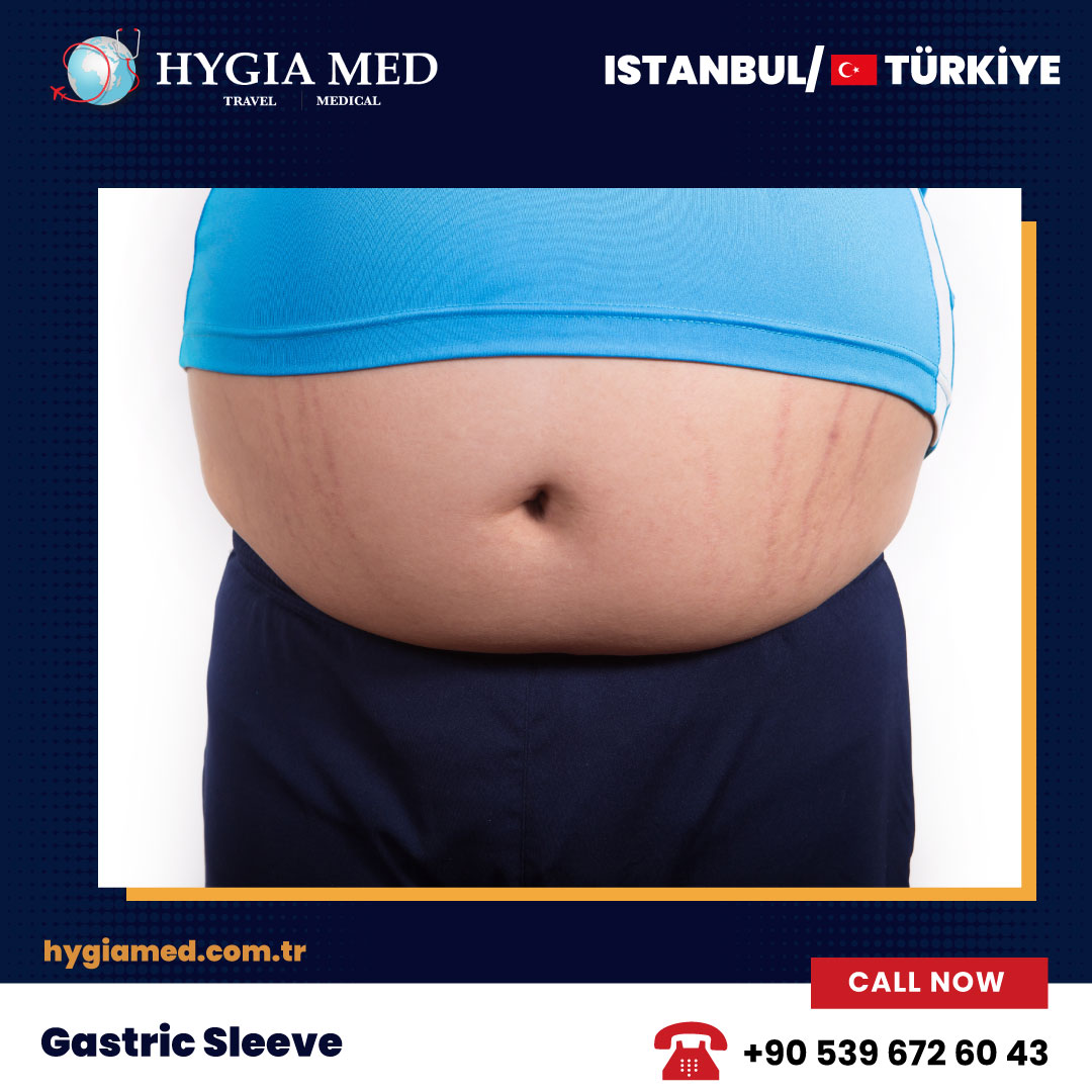 Ready to reshape your life? Dive into the transformative world of gastric sleeve surgery! 

#fitnessmotivation #dietfood #ketodiet #proteindiet #obesity #healthtransformation #dietandexercise #hygiamed #jajatravelexclusive