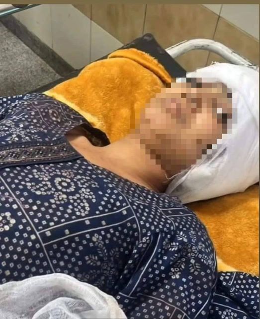 💥Both Himachal CM Sukhu & BJP’s Kangana offer free treatment to Palampur girl attacked with sickle 💥

#tnr #palampurincident #JusticeForVictim 
@BJP4Himachal @INCHimachal @SukhuSukhvinder @jairamthakurbjp @KanganaTeam 

Read Full Article👇

thenewzradar.com/himachal-prade…
