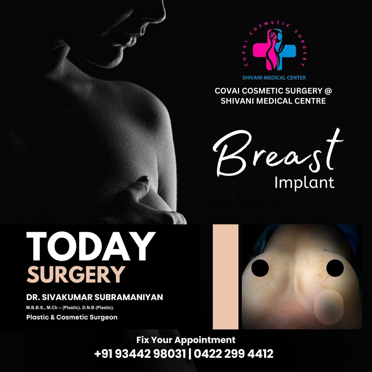 Understanding your options for breast implants can help you make an informed decision if you choose to undergo breast implant surgery.

#breastimplants #breastimplantsize #breastimplantsmiami #breastimplantstories #breastimplantsurgery #breastimplantsillness