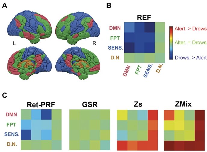[New publication] If you want to wake up your resting #fMRI data, take a look here : nature.com/articles/s4159… 🧠😴 Congratulations to the authors 🎉 for this publication in @SciReports @SpringerNature @Inserm @InsermNordOuest @Cyceron14 @Universite_Caen @CHU_Caen #sleep #MRI
