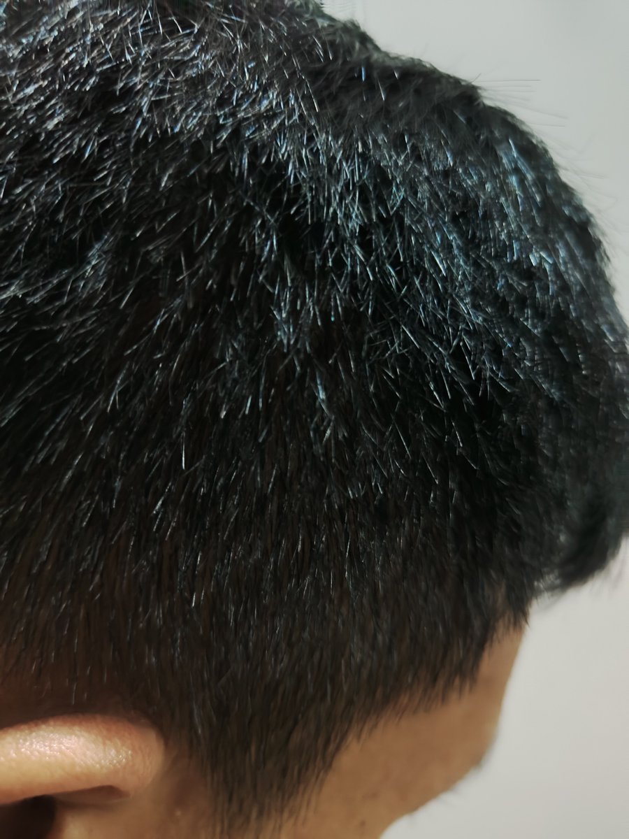 Widino's tweet photo. Karena banyak yg nanya hasilnya, kurang lebih begini lah. Ini gw pakenya jarang-jarang lho, kalo inget aja 😂

Barbershop langganan gw pernah bilang gini "skrg rambutnya lebih tebel n lebat yaa". Trus dalam hati gw bilang "oh ngefek juga ya serum rambut yg itu" wkwkw https://t.co/AbywZBzINy