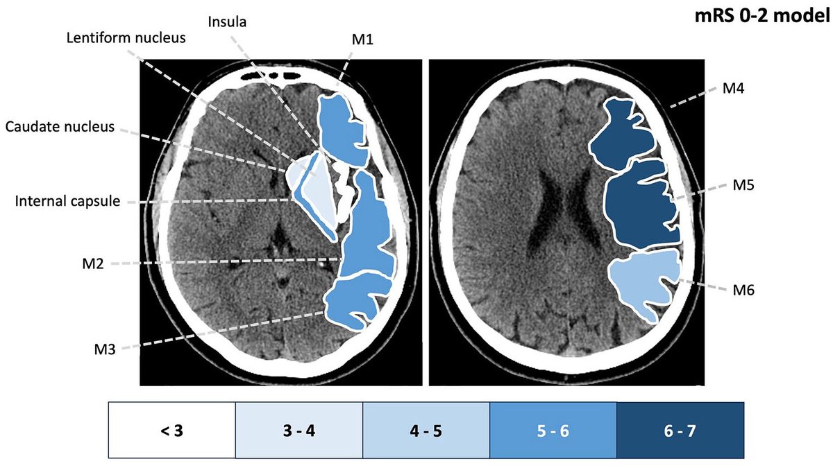 International Journal of Stroke tweet media