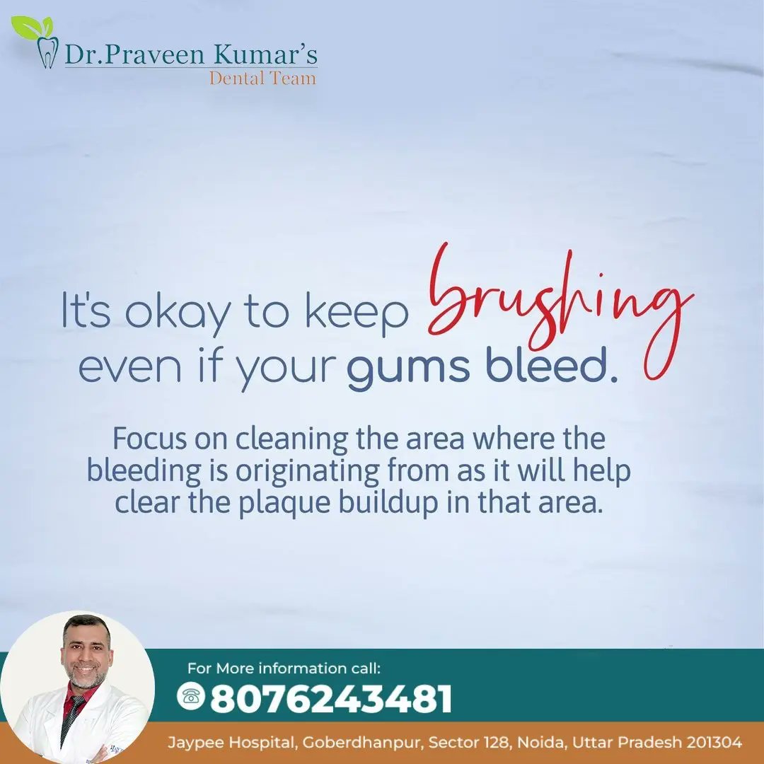 Keep brushing even if your gums bleed. Bleeding gums can be a sign of gum disease, but avoiding brushing altogether can make the problem worse.
 
For more information call now
🧑‍⚕Dr. Praveen kumar
📱8076243481

#DentalCrowns #SmileRestoration #OralHealth
#DentalSensitivity