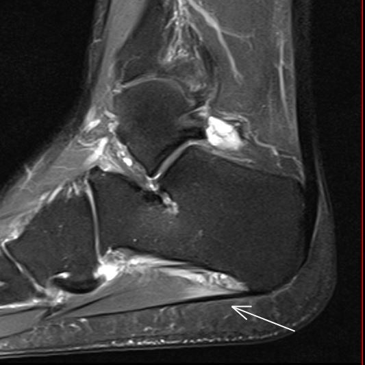 JuanMiranda tweet media