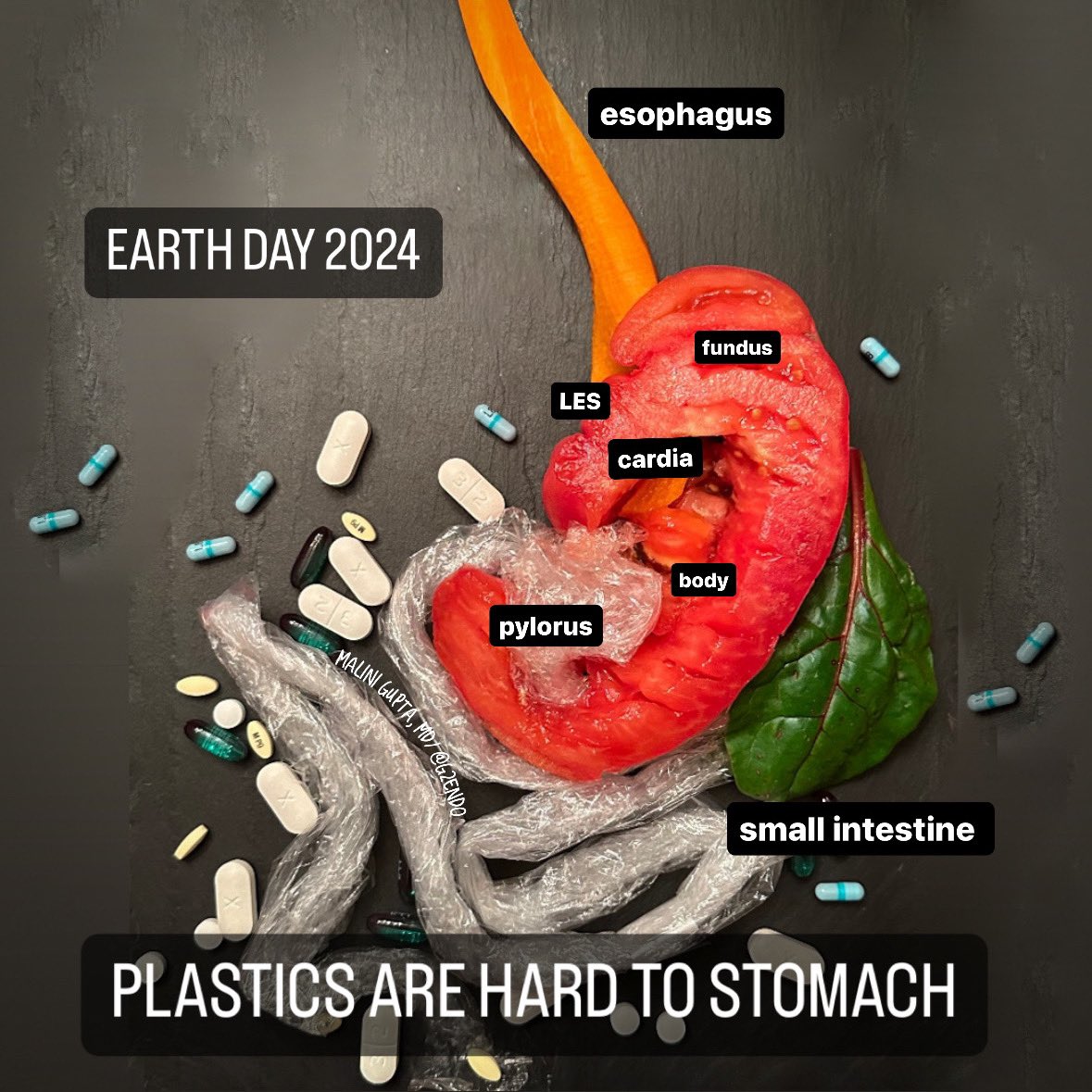 We are ingesting plastics from our food packaging, but the plastics are also harming the earth. On #EarthDay2024 go #plasticfree! #MedEd #Endocrinology