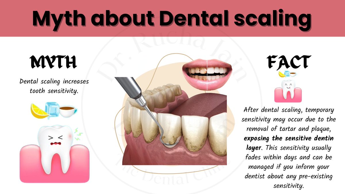 RuchaDentodream's tweet image. Post-cleaning sensitivity? It happens. Teeth are adjusting to the oral environment after a break. Usually fades within a week.
#teethsensitivity #dentalscaling #durg #dentistatdurg #DentalCare