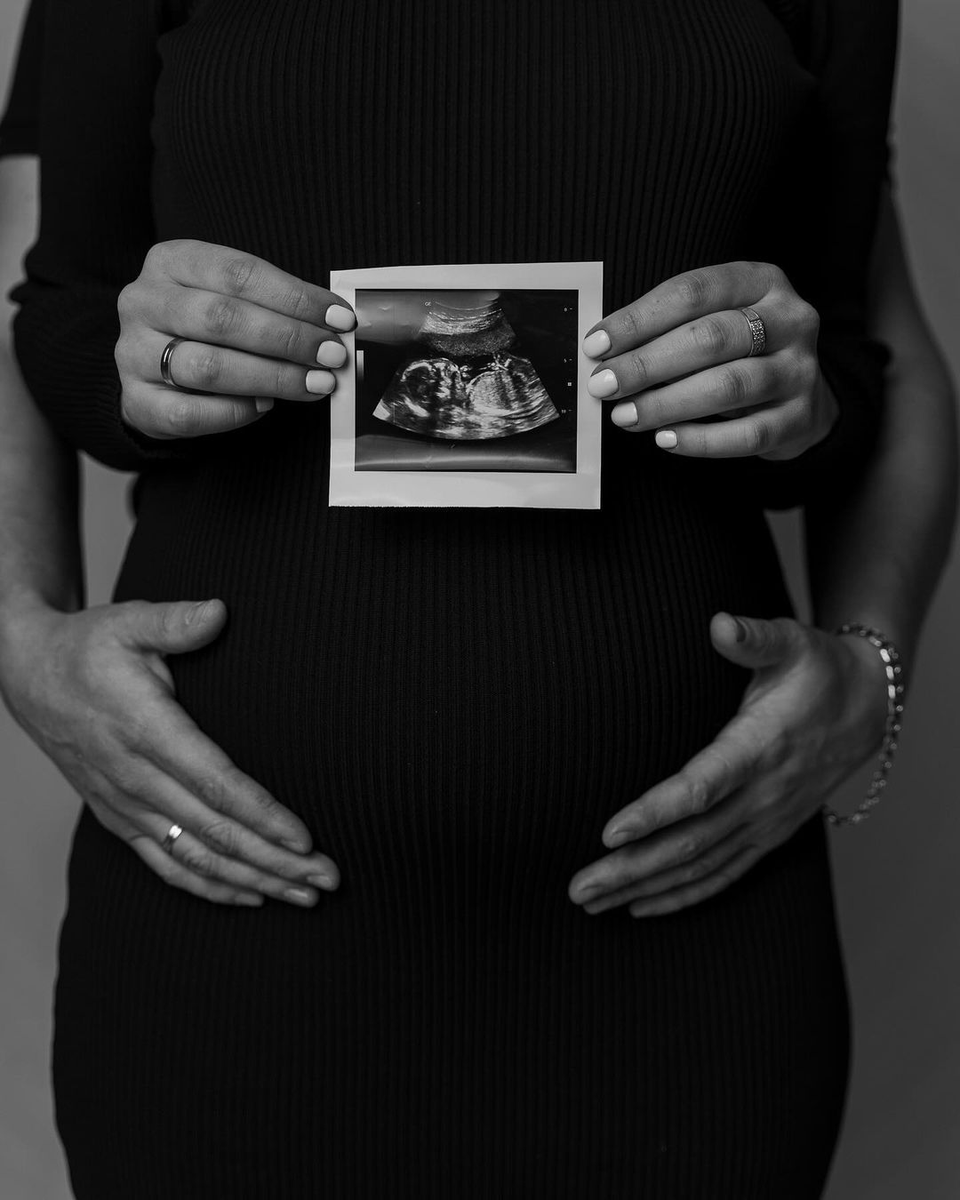 C_Barg_eman's tweet photo. Capturing the beauty of motherhood in every frame! 📸✨ It was an honor to photograph  radiant pregnancy glow. #MaternityPhotography #MotherhoodJourney https://t.co/2Att8TyLKs