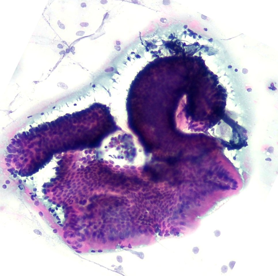 'A Cyto-Swan' to start the week 🦢 
Be happy 🦢🤍 #CytoPath #Pathart