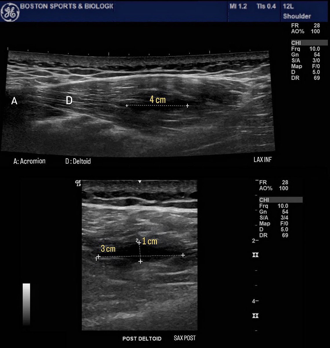 Erek Latzka MD, RMSK tweet media