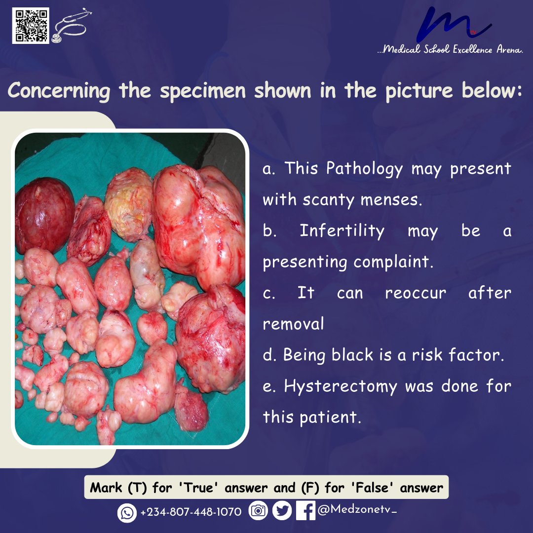 Can you tackle this Picture quiz challenge?
Test your medical knowledge and diagnostic skills.

Please drop your answers in the comments.

#Medstudent #Medschool #MedicalQuiz #ClinicalSkills #FutureDoc #HealthcareEducation #MedicalKnowledge #MedicalQuestion