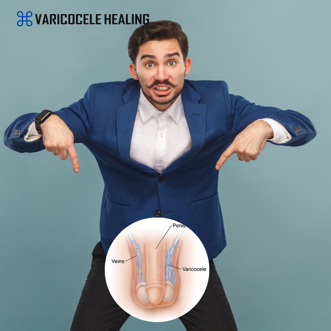 Can someone tell my veins to take it easy down there? 🥊

I GOT A TREATMENT 👉bit.ly/3UOfPgo
#Varicocele ##WellnessGoals