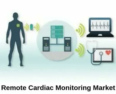 #Remote #Cardiac #Services #Market was valued at USD 6.49 Billion in 2022, and it is expected to reach USD 11.09 #Billion by 2029.

Dive into the details:rb.gy/cewe7t
#RemoteCardiacServices #Telemedicine #CardiacMonitoring #HeartHealth #RemoteHealthcare #Wearable