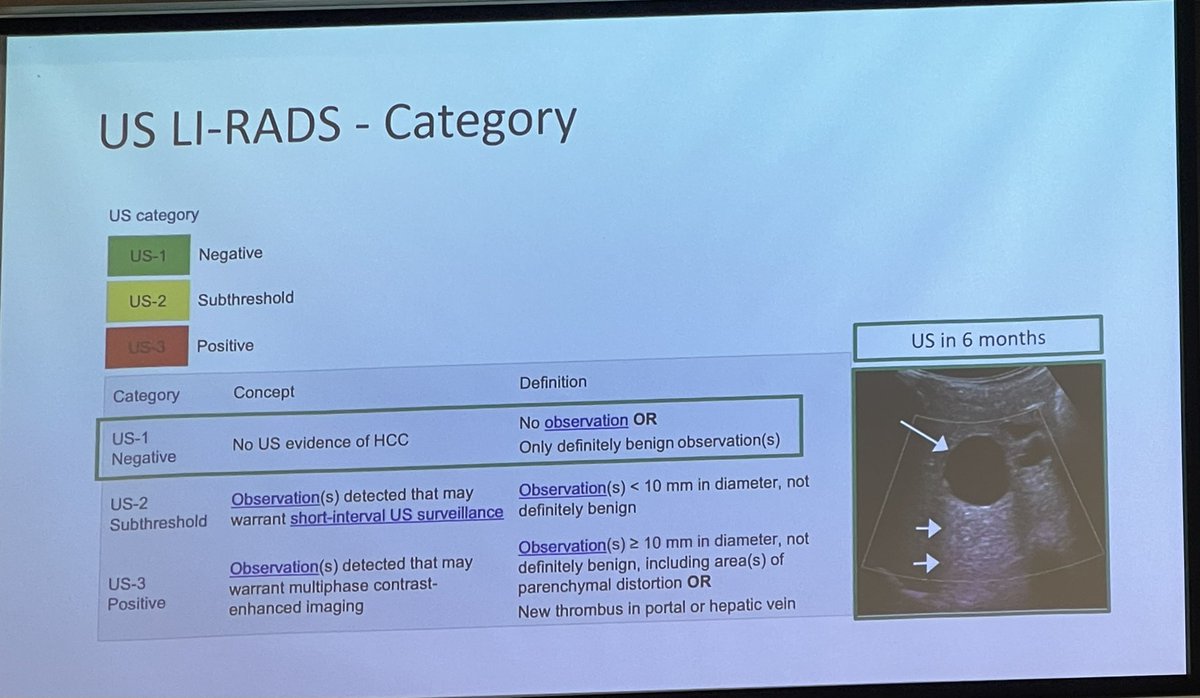 Almo0ou's tweet photo. Excellent talk at #BASL Monothematic meeting: Improving surveillance for hepatocellular carcinoma in the UK by @JamesMFranklin on improving surveillance delivery. Adoption of standardised reporting using US LI-RADS might be the key ! https://t.co/0ajHzWlovI