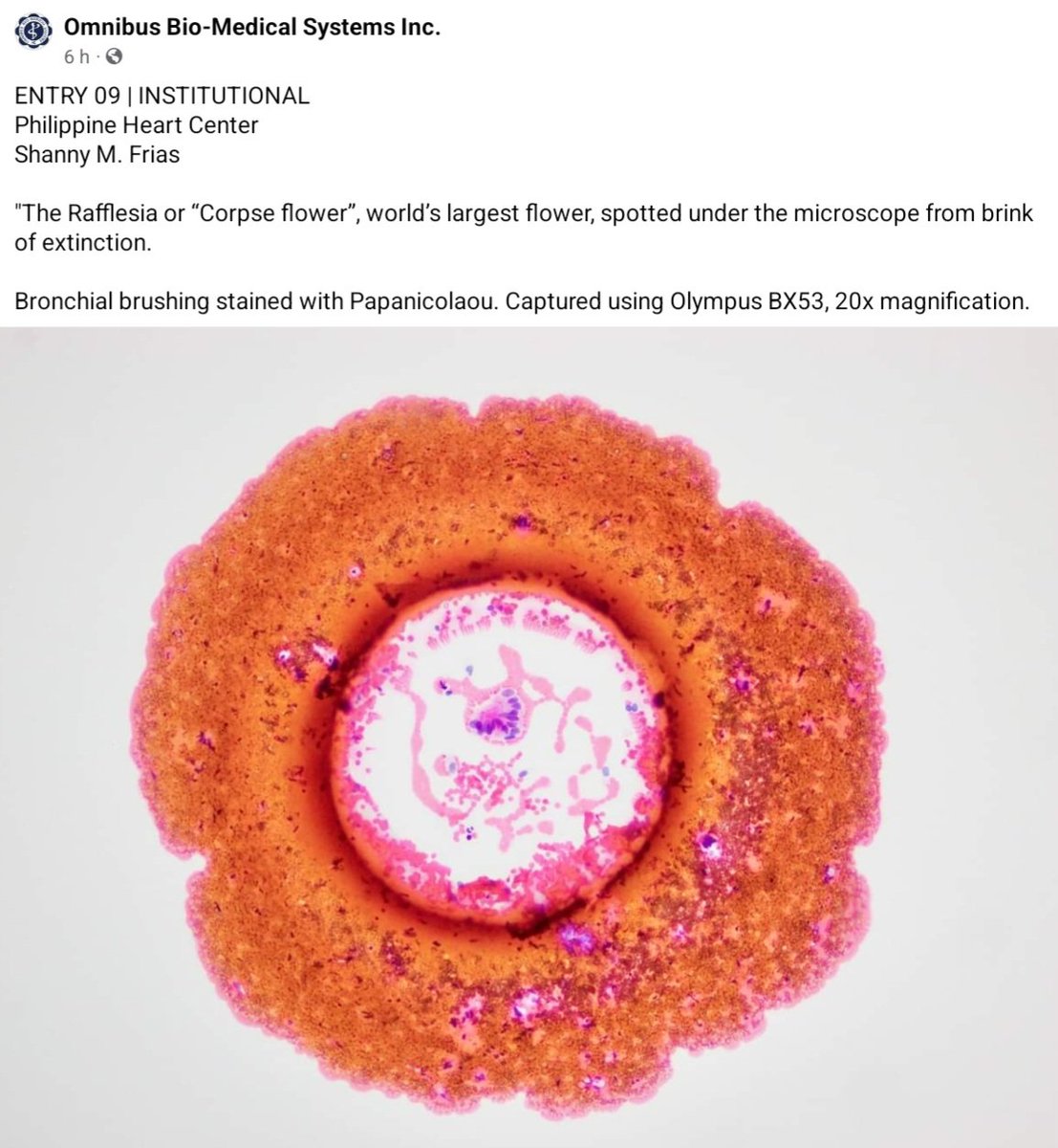 Snapshots 2021 Photomicroscopy Contest Institutional Category Philippine Society of Pathologists 🔬 73rd Annual Convention 25-27 April 2024 facebook.com/share/FhqSBiHm…