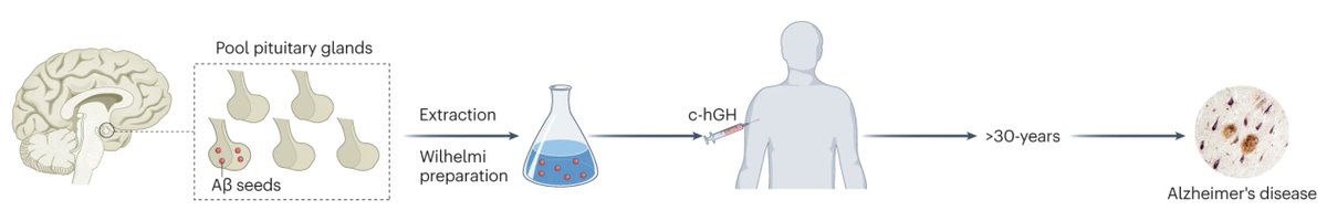 Credible evidence for iatrogenic transmission of #AlzheimersDisease (AD)—Under extraordinary circumstances, AD may be transmitted by a prion-like mechanism to recipients of cadaveric pituitary-derived growth hormone. 
nature.com/articles/s4159…
nature.com/articles/s4159…